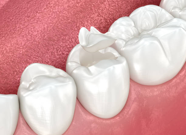 Best Wisdom Tooth Removal  in Live Oak, FL